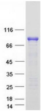 Coomassie blue staining of purified FOXO3 protein.